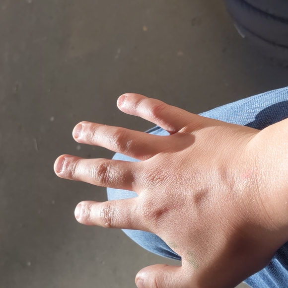 My hand - Picture 4 of 5